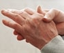 Rheumatoid Arthritis