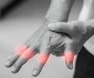 Tendon Finger Injury